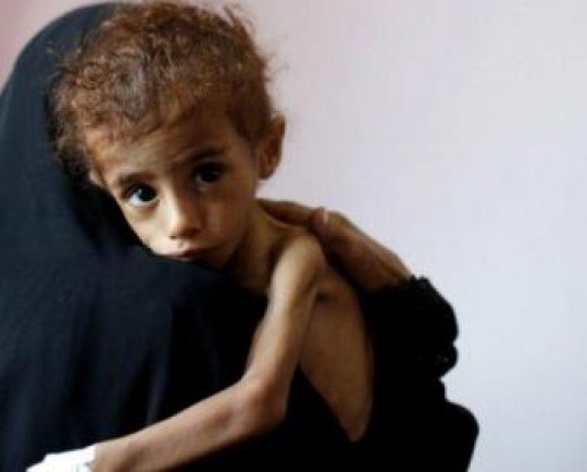سازمان ملل: منابع مالی برای تغذیه مردم یمن رو به اتمام است
