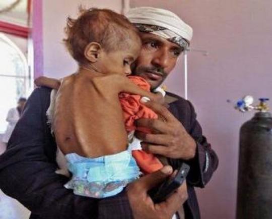 راهاندازی کمپین جهانی برای لغو محاصره یمن