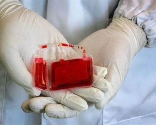 نجات جان 27 کودک با استفاده از یک زباله بیولوژیکی/ خون بندناف منبعی غنی از سلول‌های بنیادی